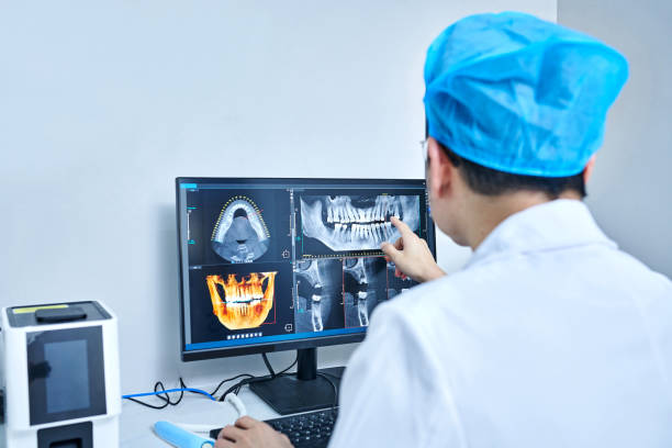 Best Emergency Tooth Extraction in Mauldin, SC